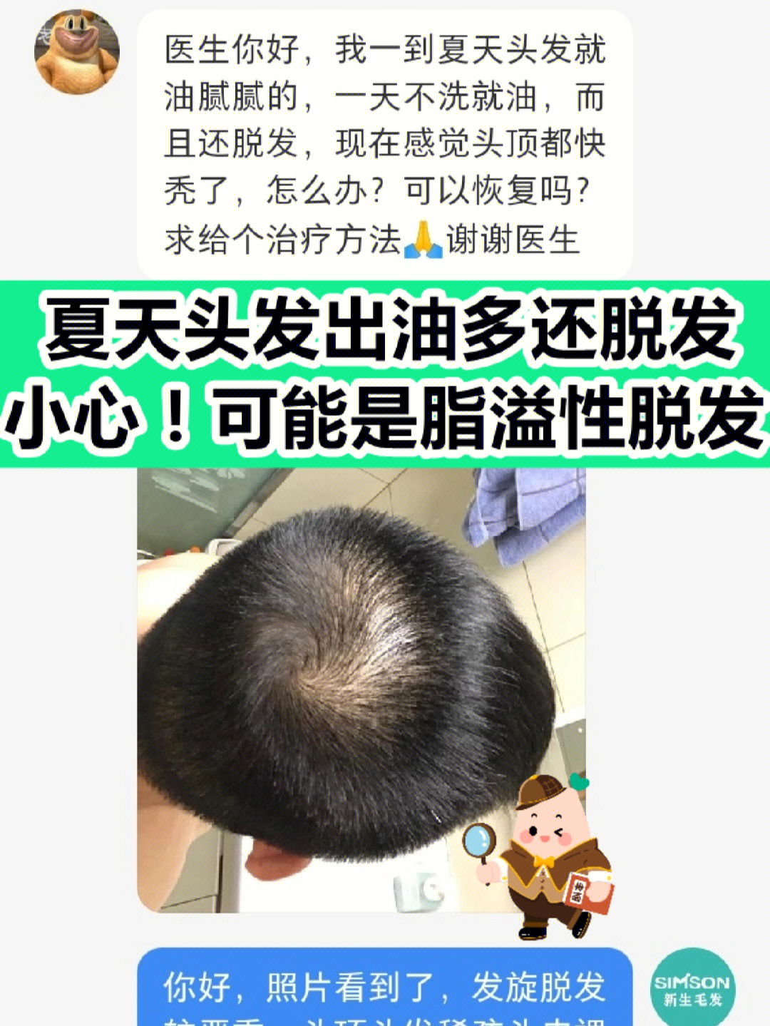 98697115夏天头发油脱发,小心脂溢性脱发