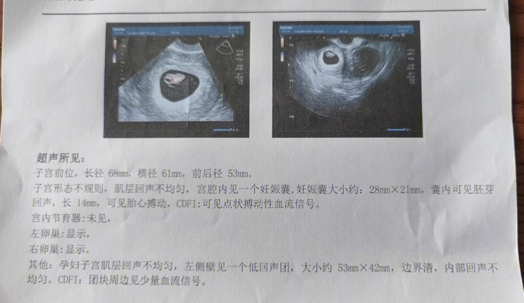 孕囊胚芽对照表图图片