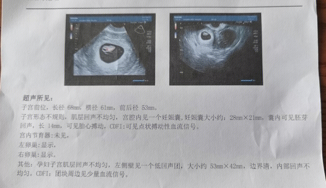 9mm囊肿多大图片图片