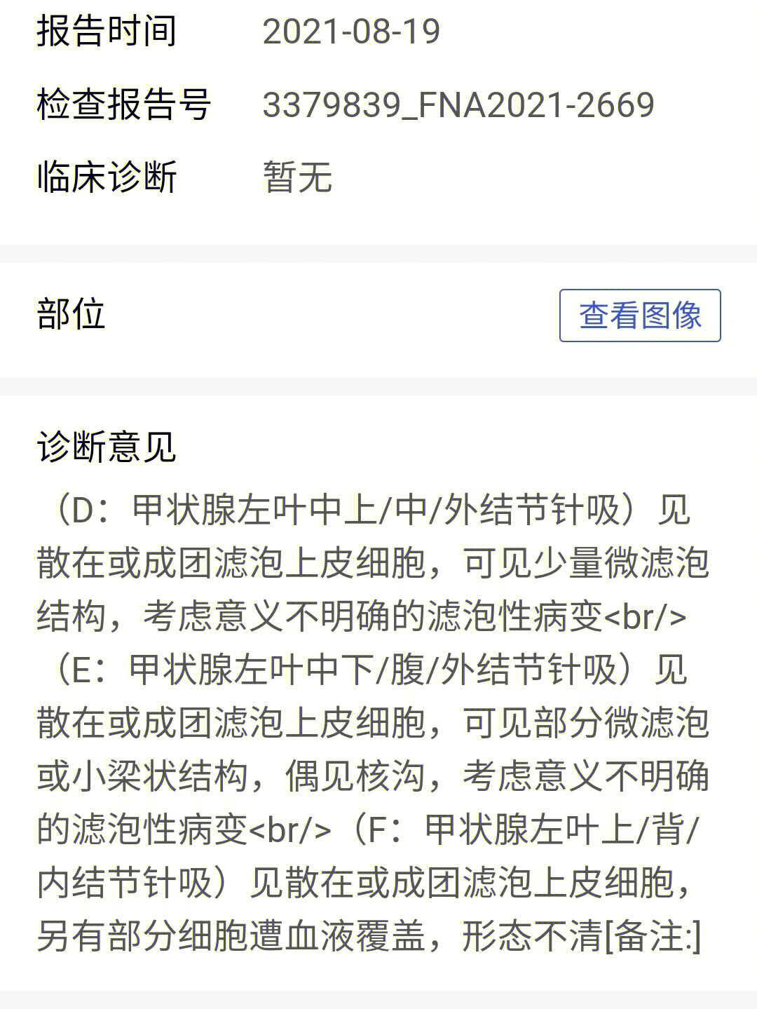 甲状腺穿刺报告解读图片