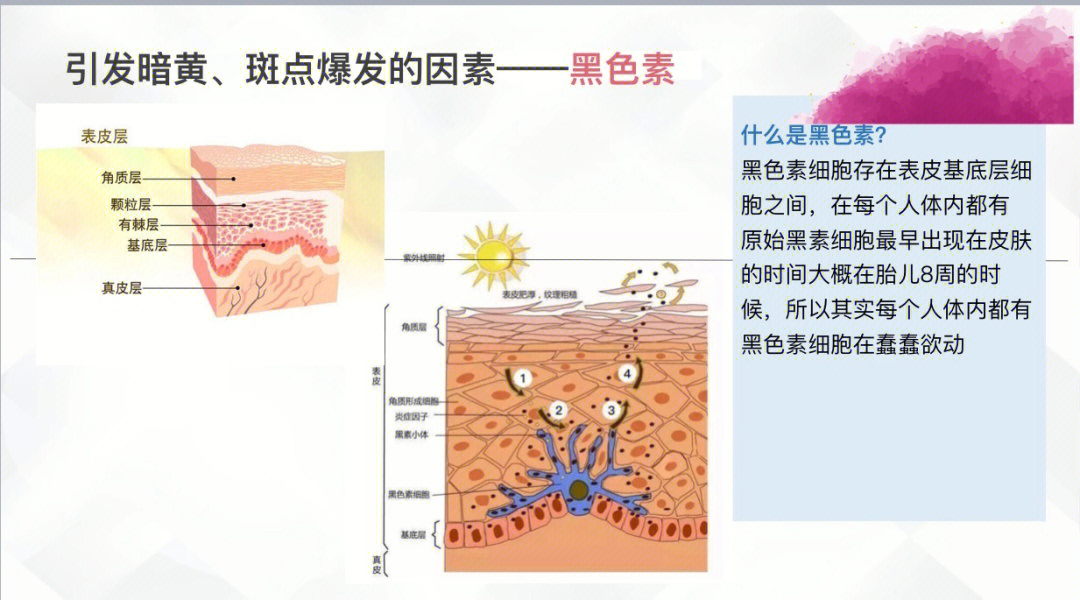 日晒斑是怎么形成的图片