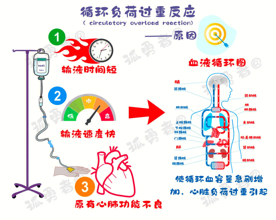 acute pulmonary edema图片