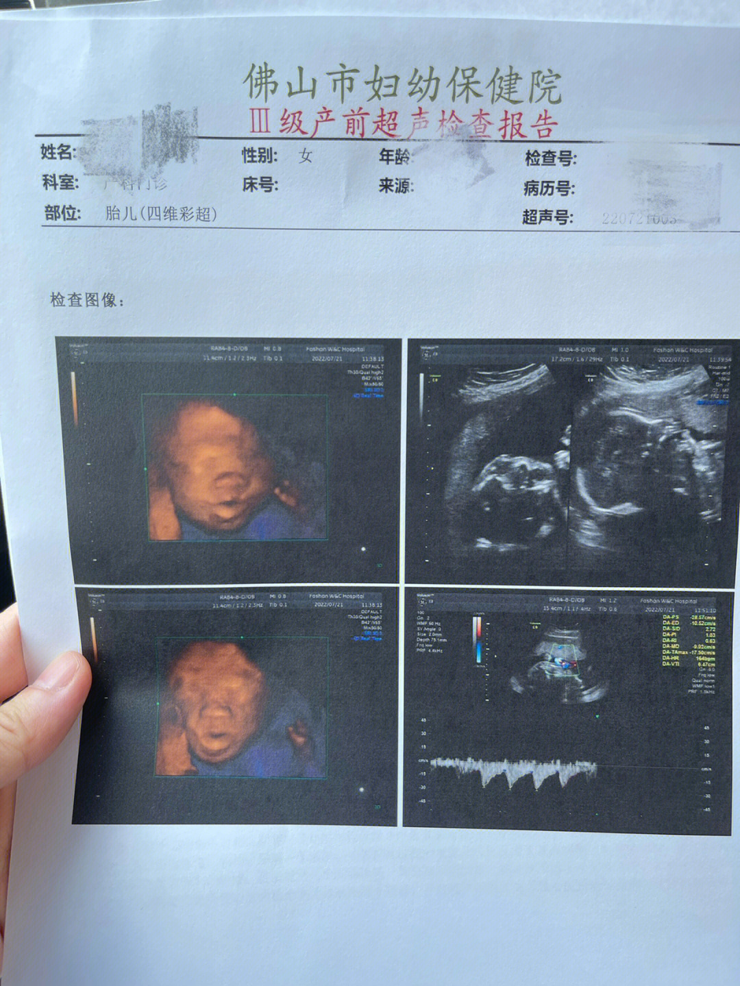 四维顺利通过孕23周