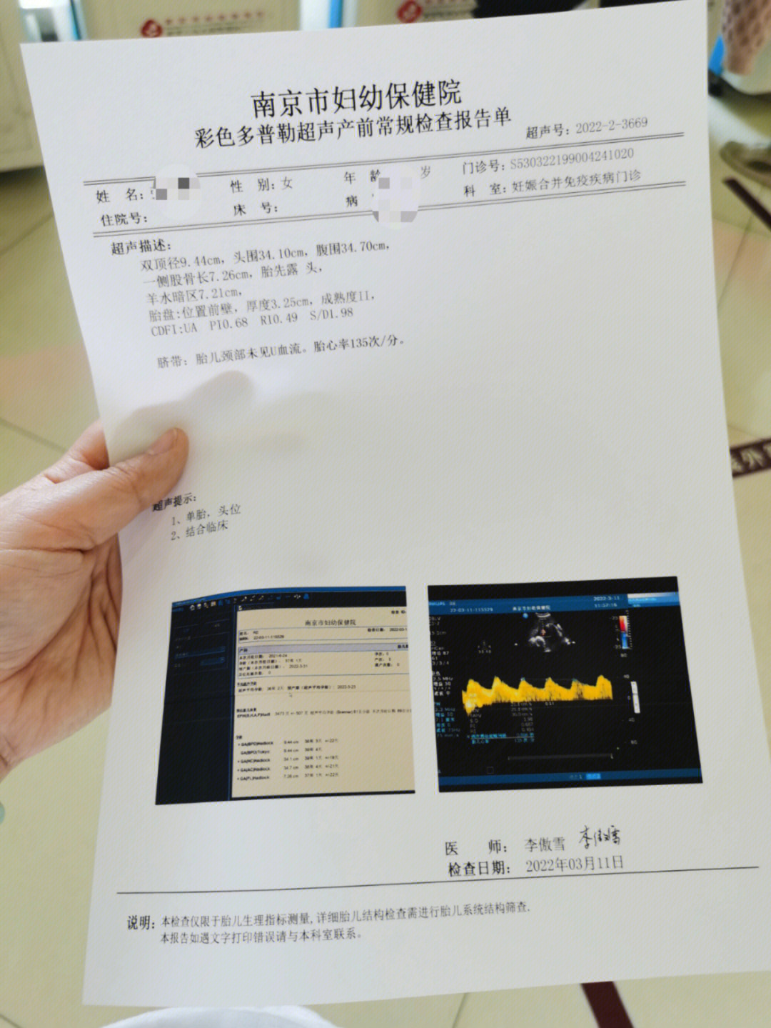 37周的宝宝那么大0101