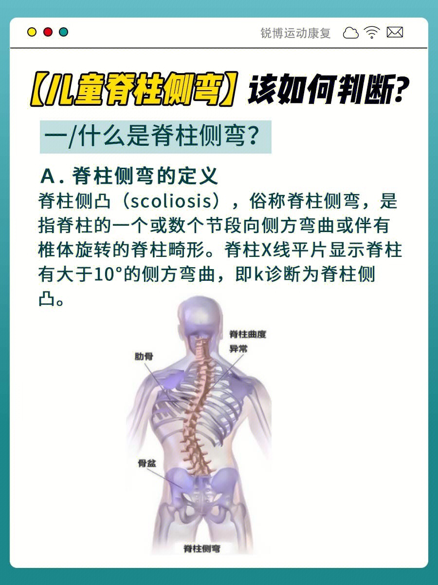 小孩颈椎侧弯图片图片