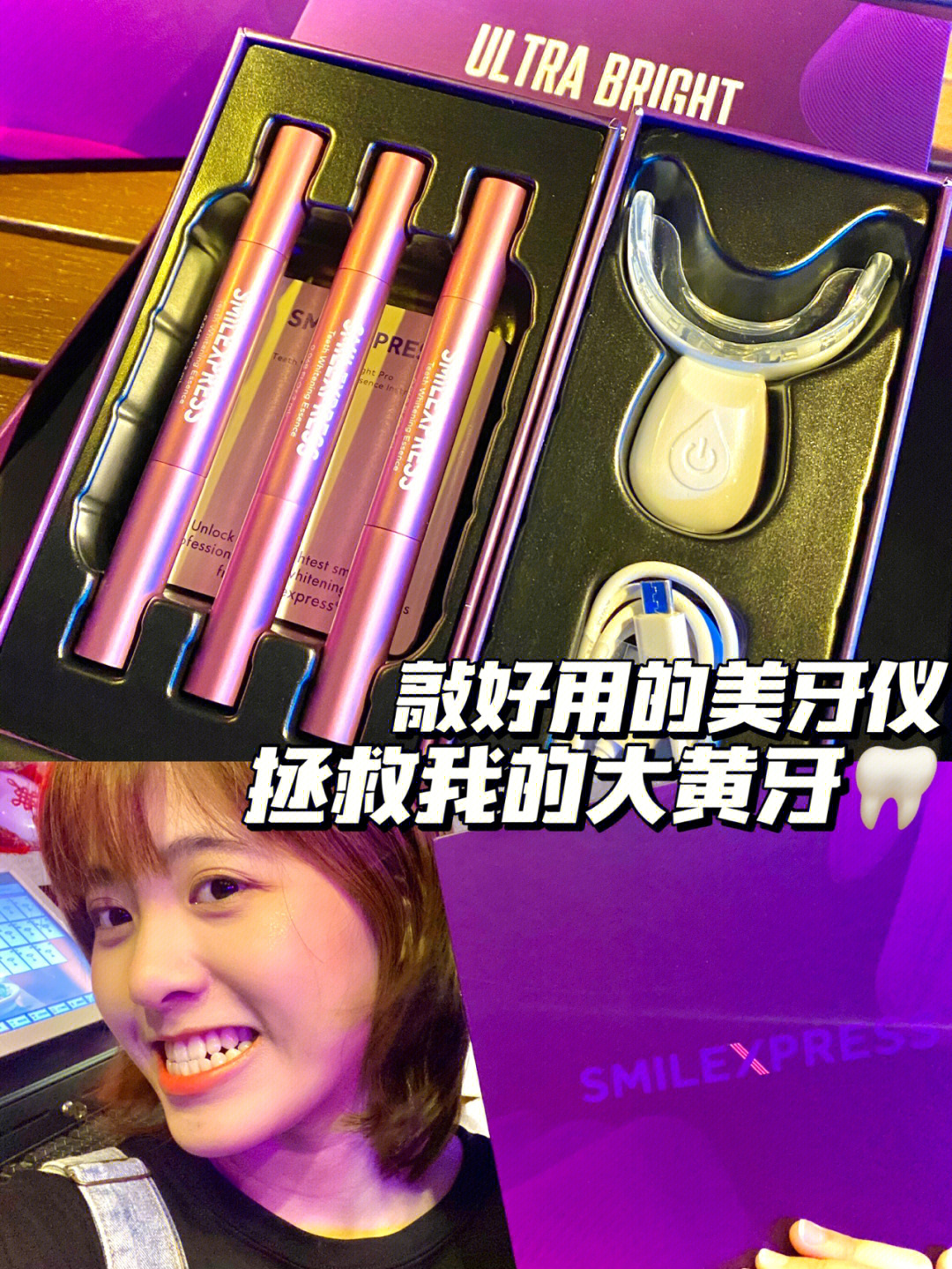 smilexpress美牙神器07大黄牙快走开