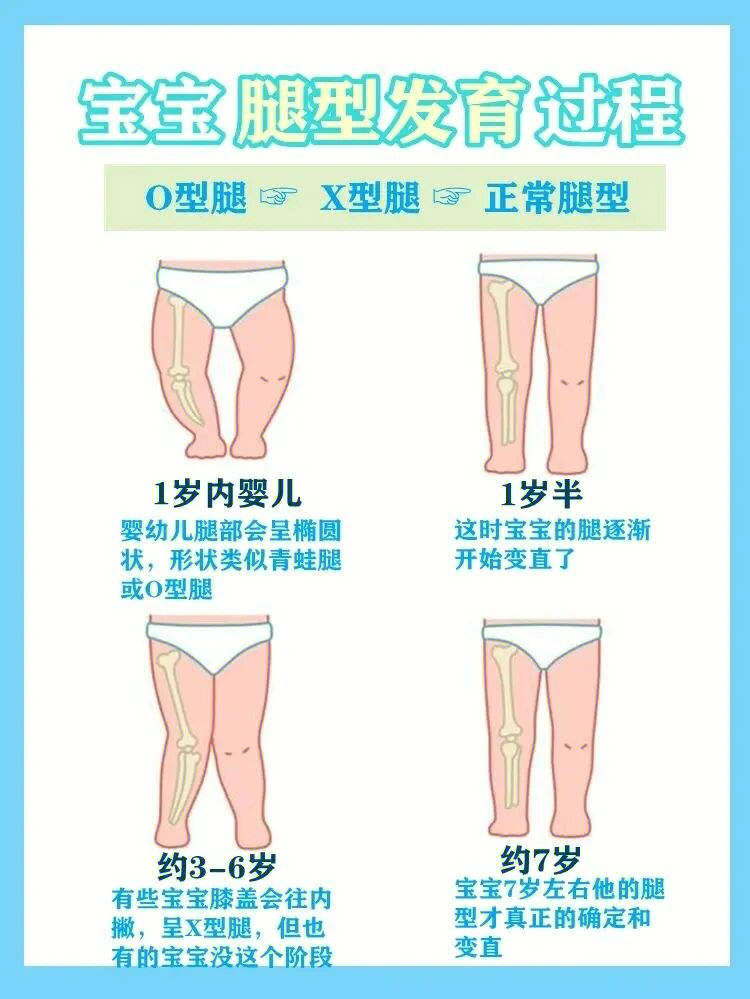 儿童腿型发育图图片