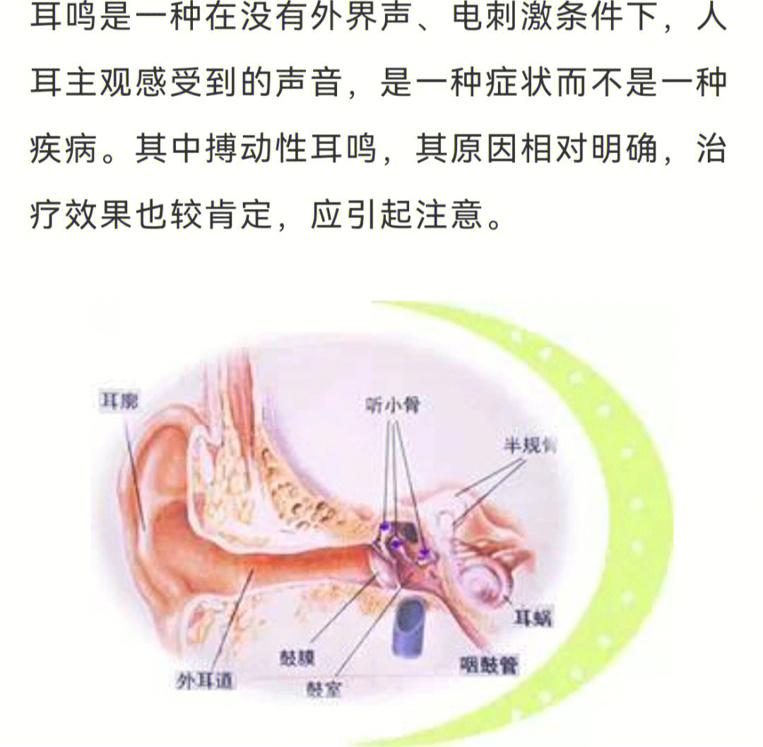 如何治疗耳鸣图片