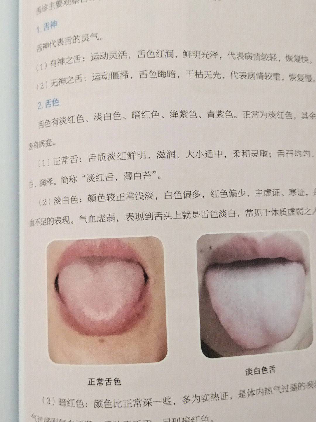正常舌背部高清图片图片
