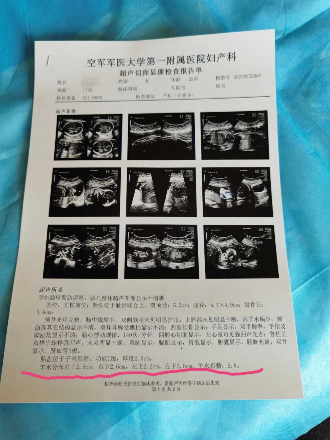 西京医院7月21日做了胎儿心脏彩超,左心室有强光点和三尖瓣反流(少量)