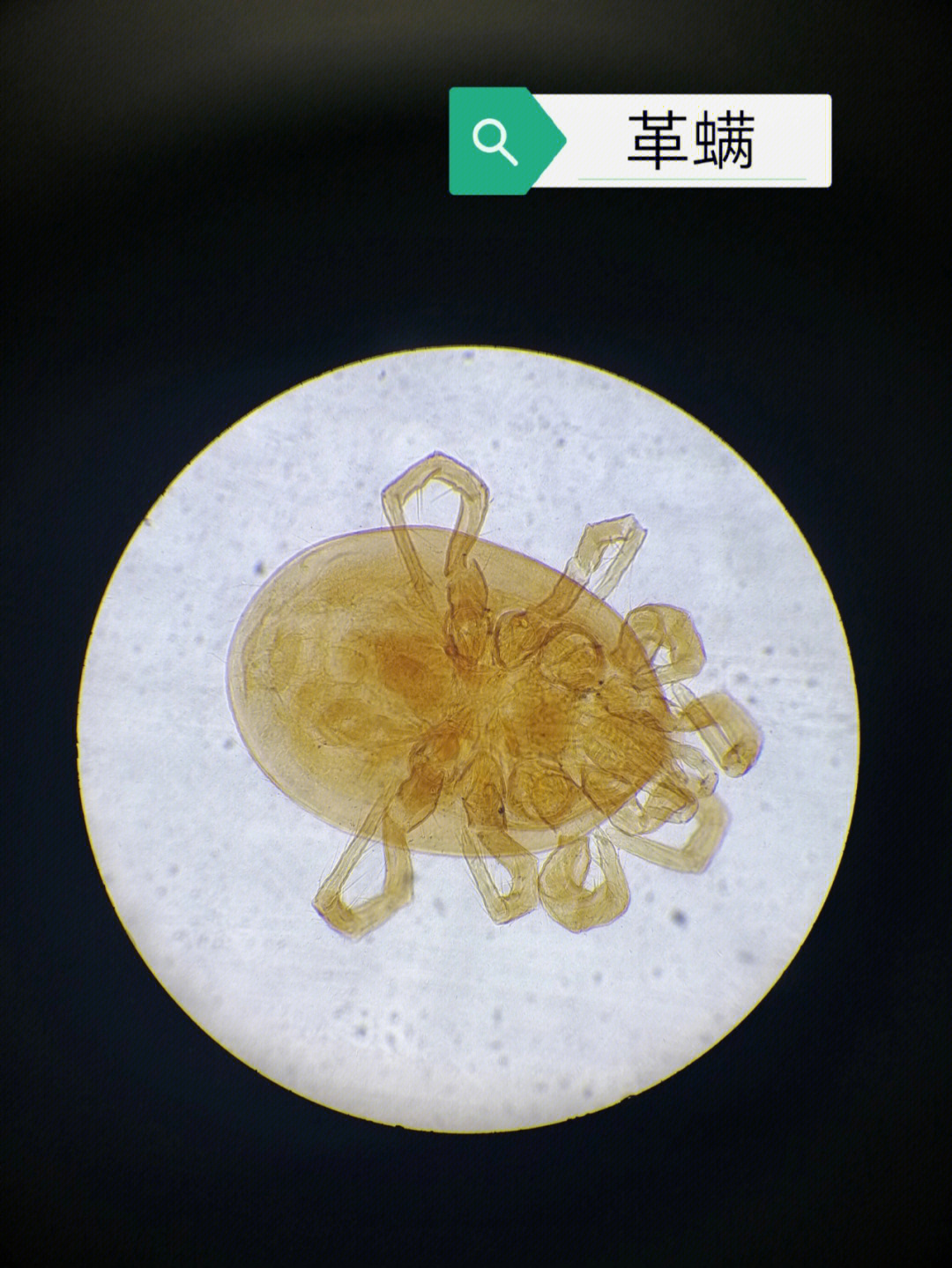 显微镜下的螨虫 脸上图片