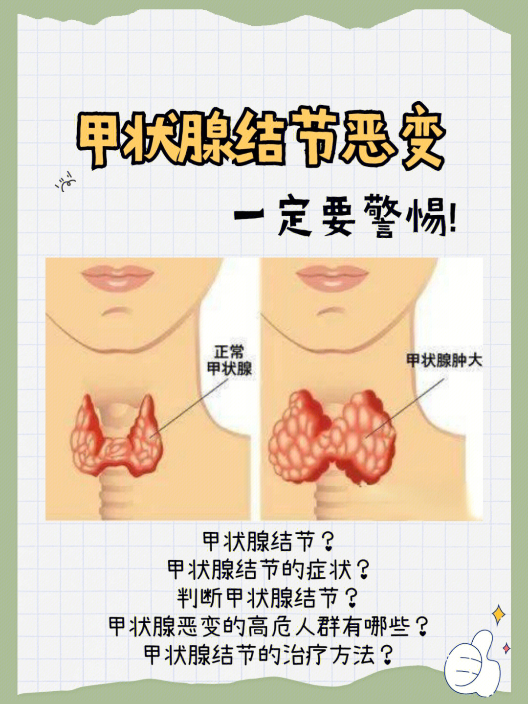 甲状腺结节自查图图片