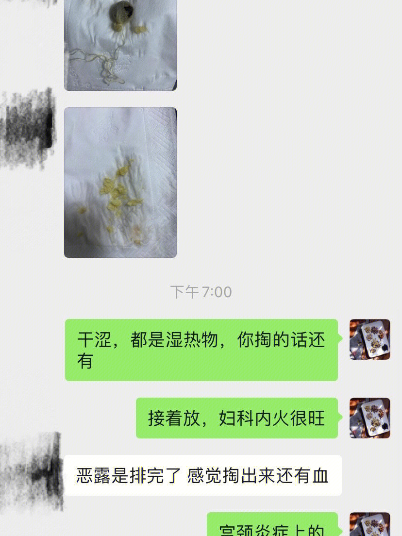 顺产下面肉球图片