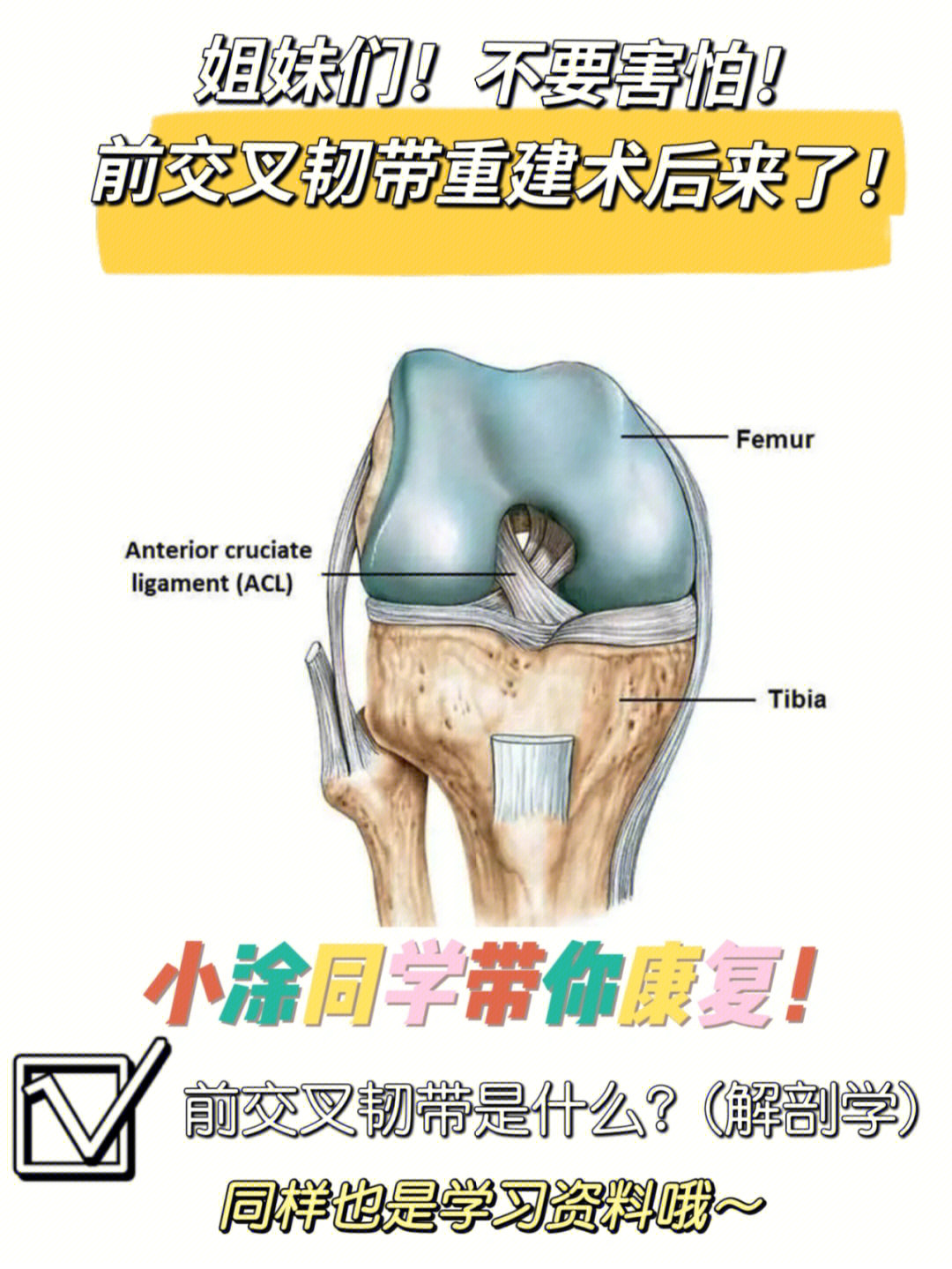 前交叉韧带(acl)的解剖学[一r]位置前交叉韧带起自胫骨髁间隆起的前方