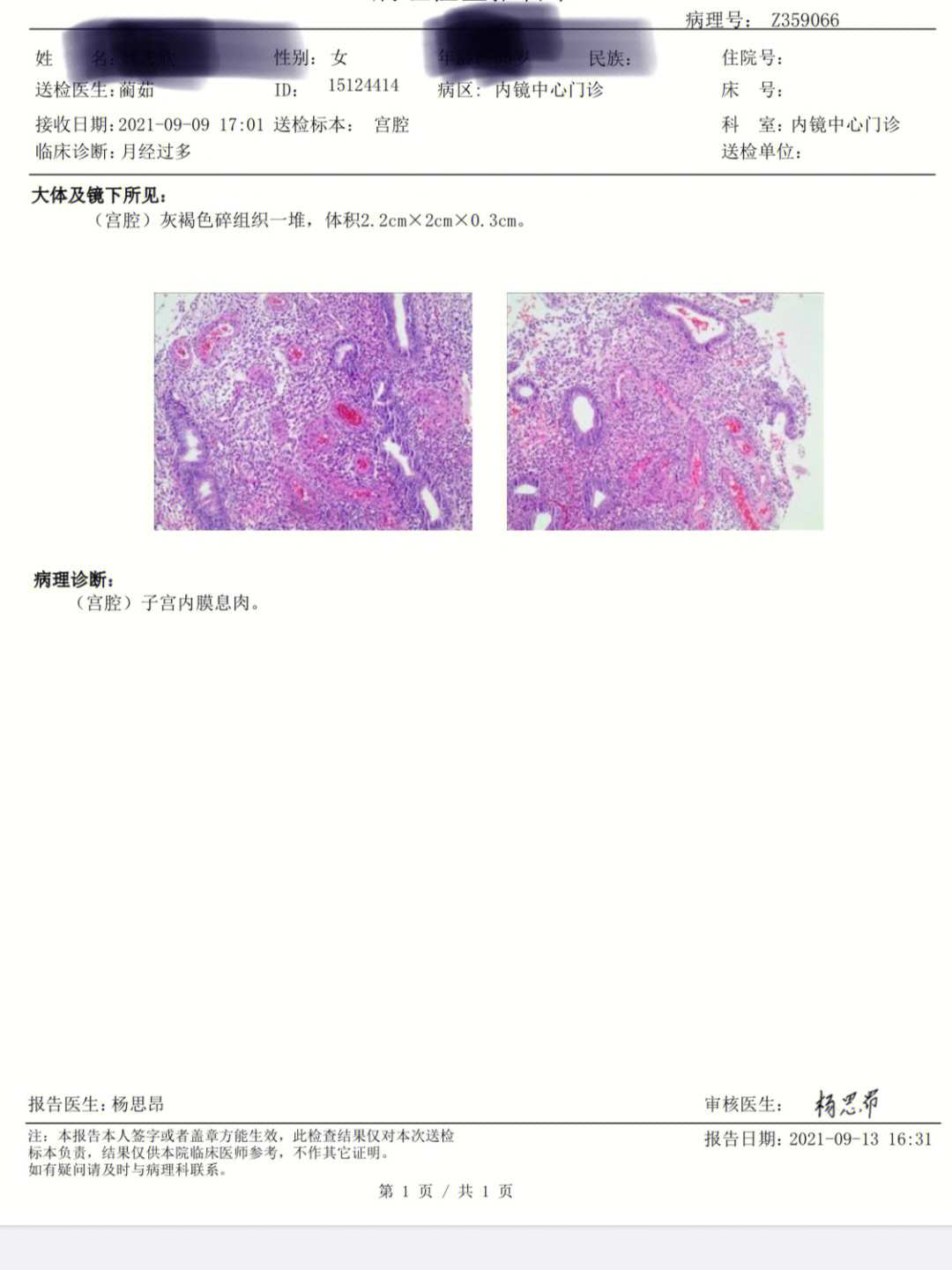 宫颈息肉病理报告图片