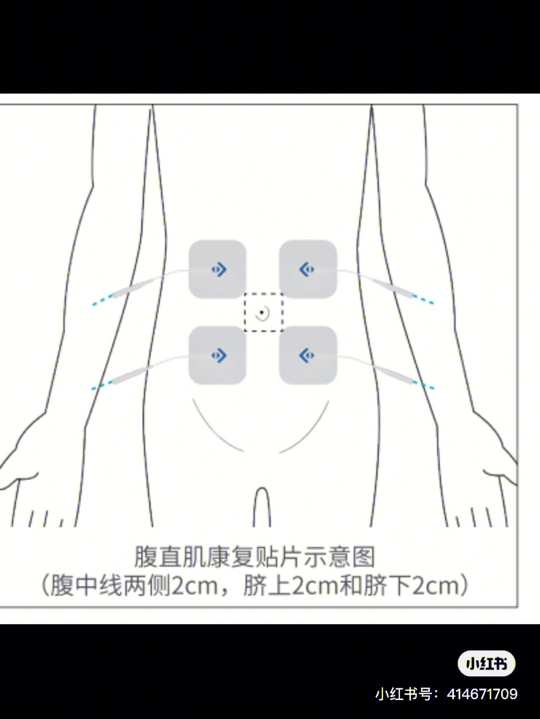 肌肉贴布腰部贴法图图片