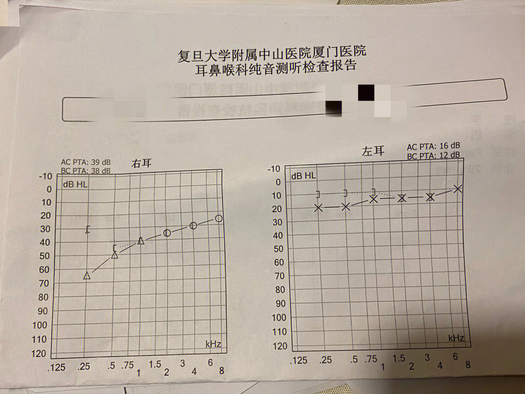 一定要及时就医,挂了四天水终于正常了01