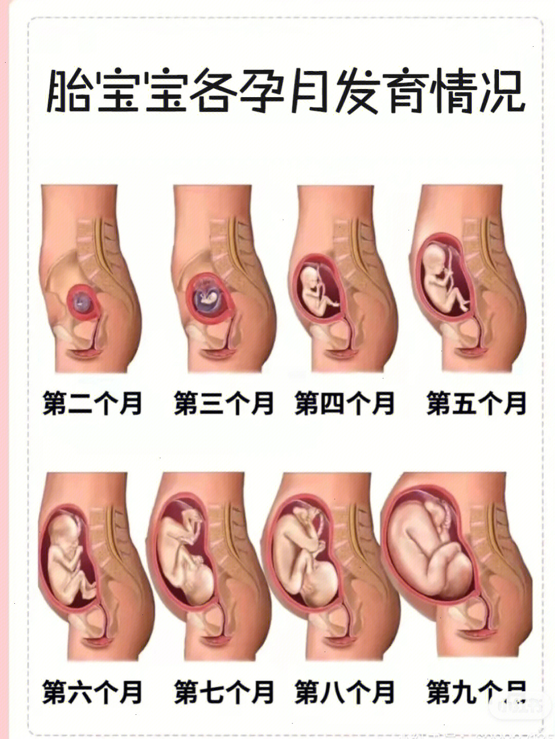 巨结肠宝宝肚子图片图片