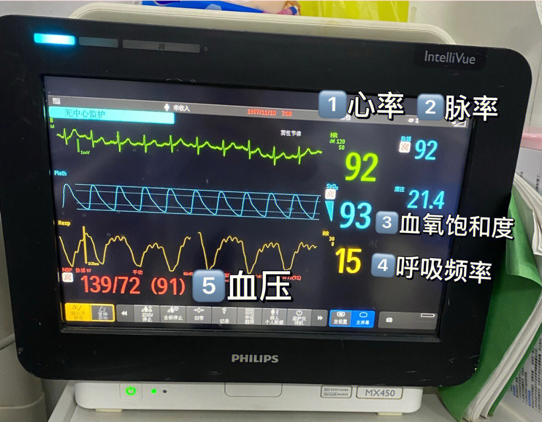 医学生必备技能看懂心电监护参数