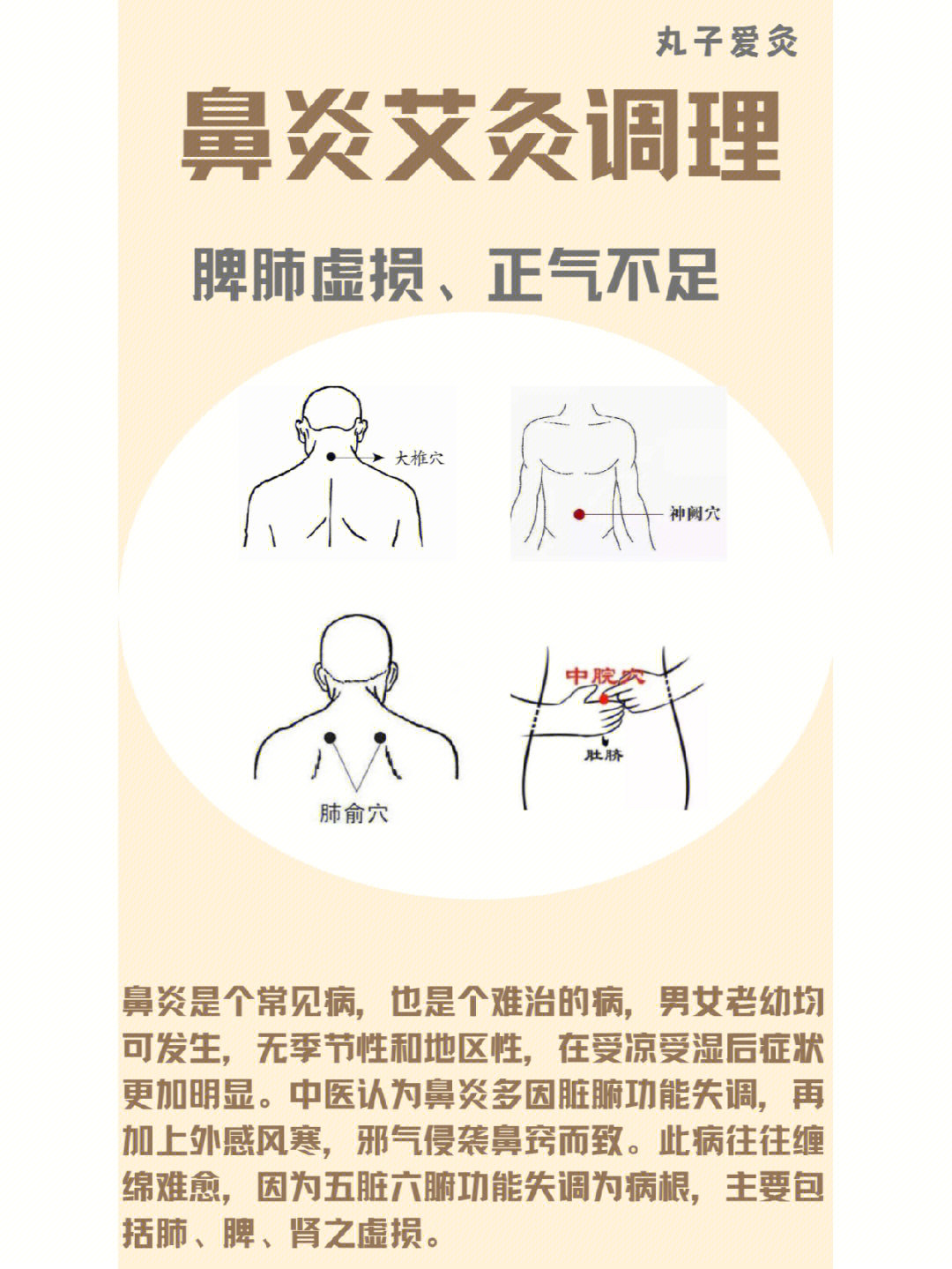 艾灸治过敏性鼻炎图解图片