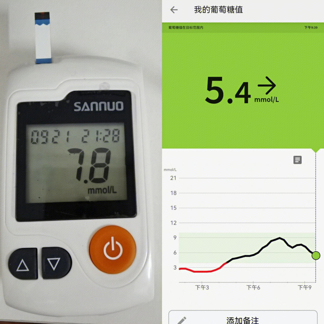 雅培瞬感血糖仪医院版图片