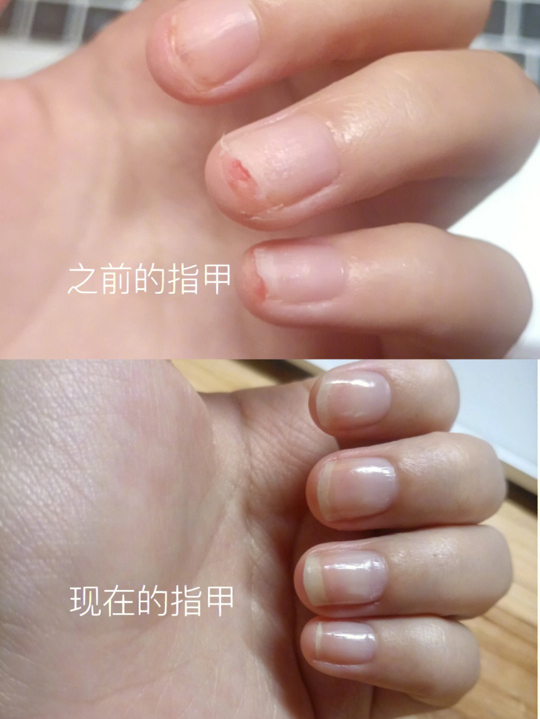 之前的指甲到现在的指甲对比
