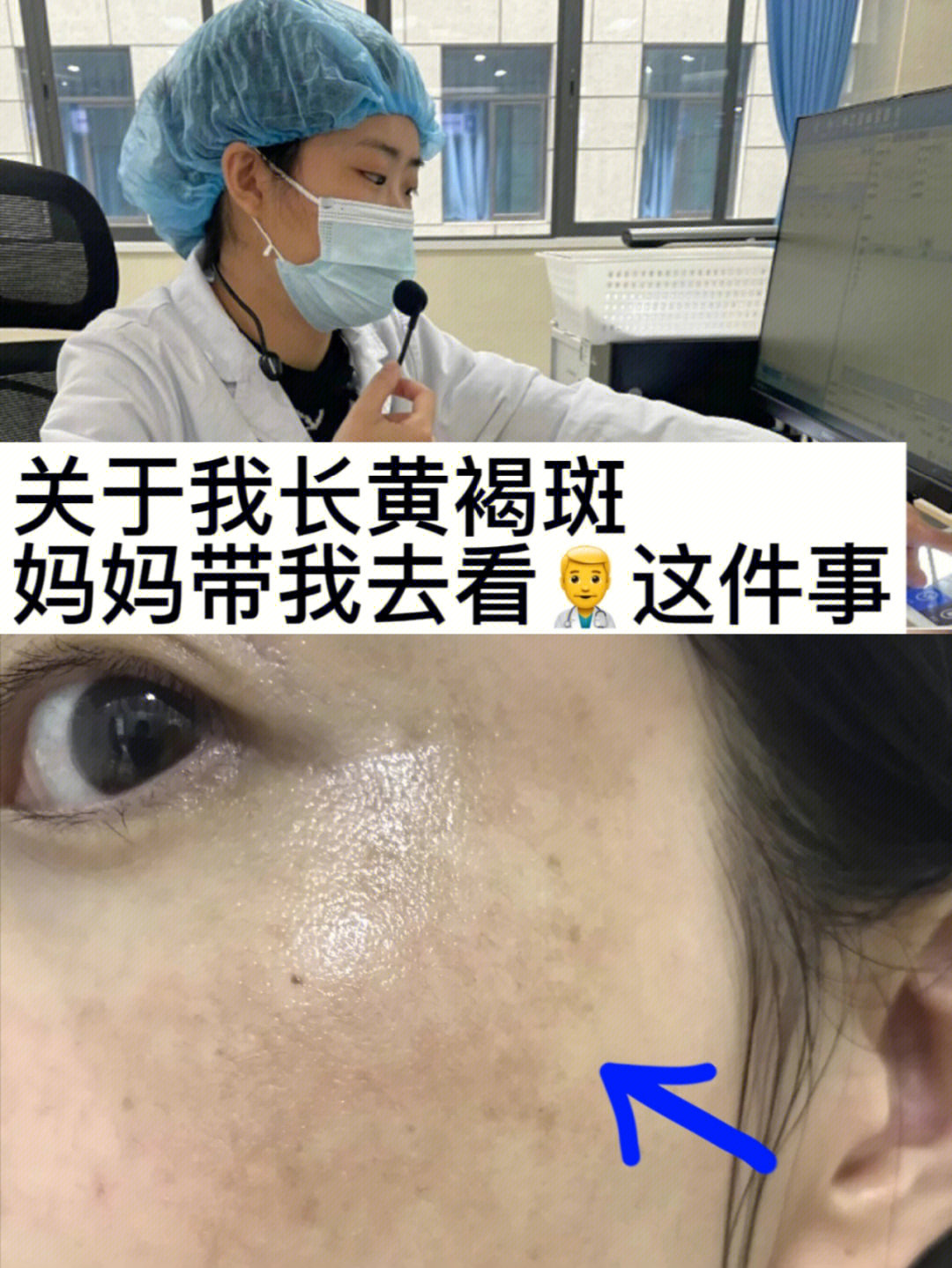 平常脸上就很粗糙还爱起皮,不知道什么时候眼角就出现了有一些小黄点