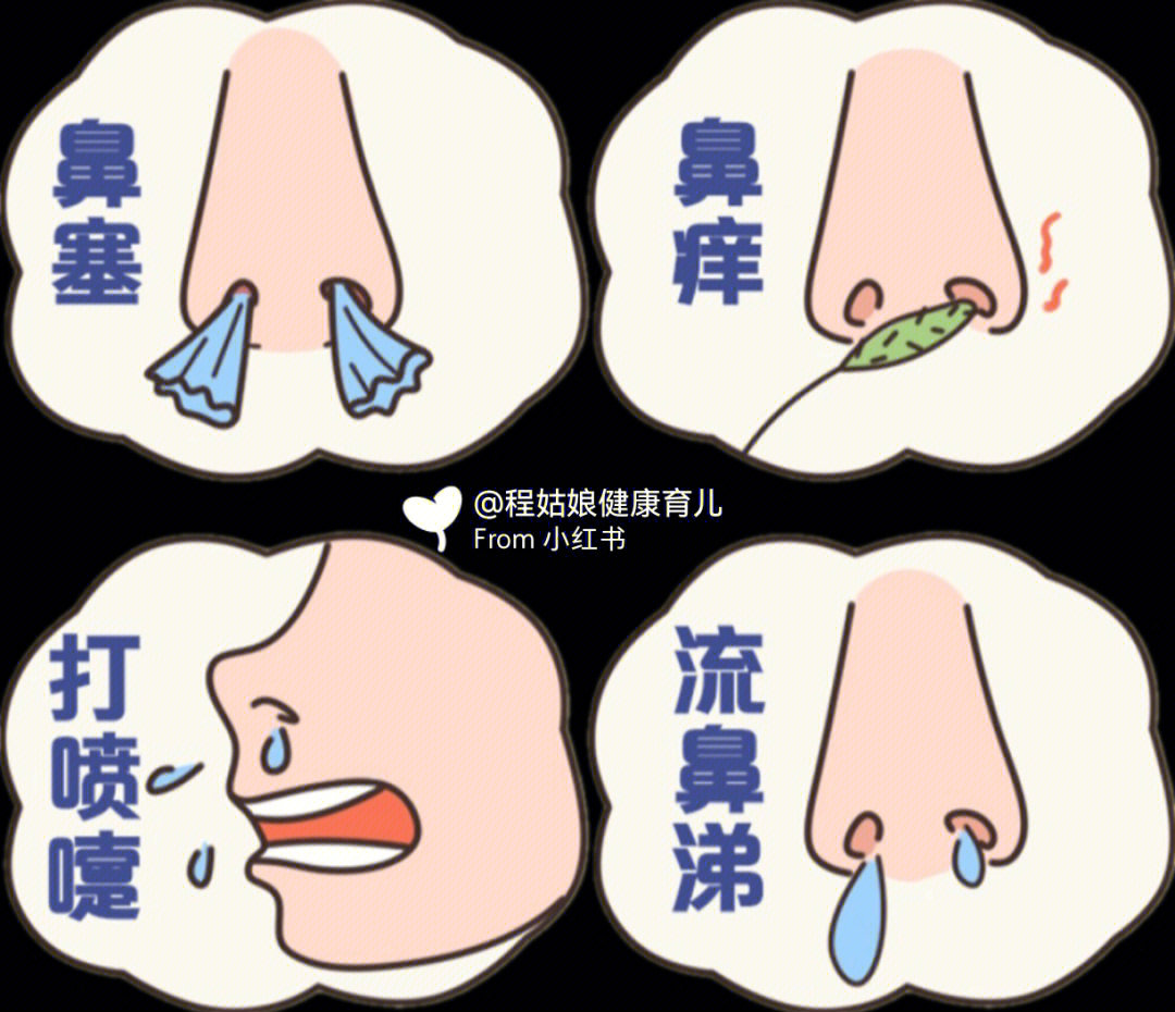 过敏性鼻炎怎样才能不折磨孩子04