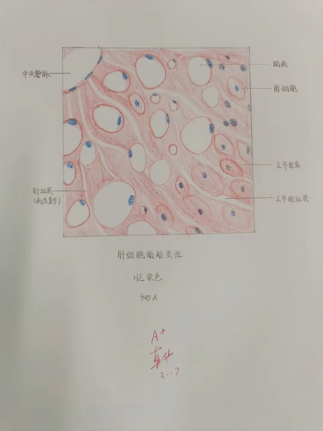 病理红蓝绘图分享上