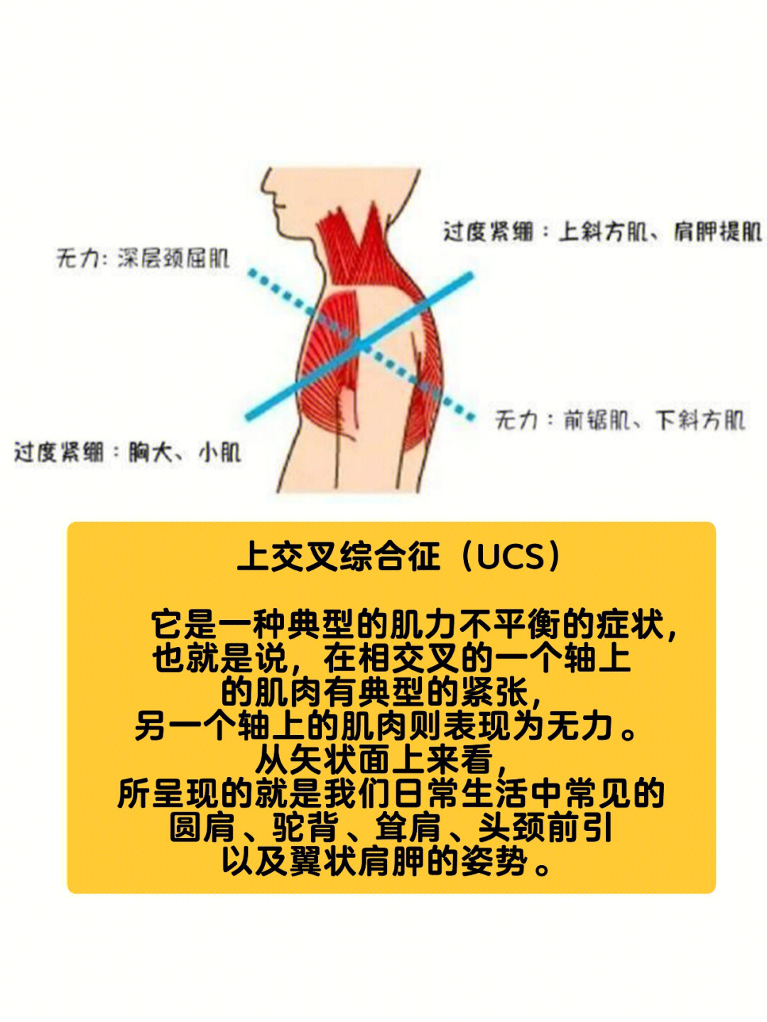 圆肩的危害图片