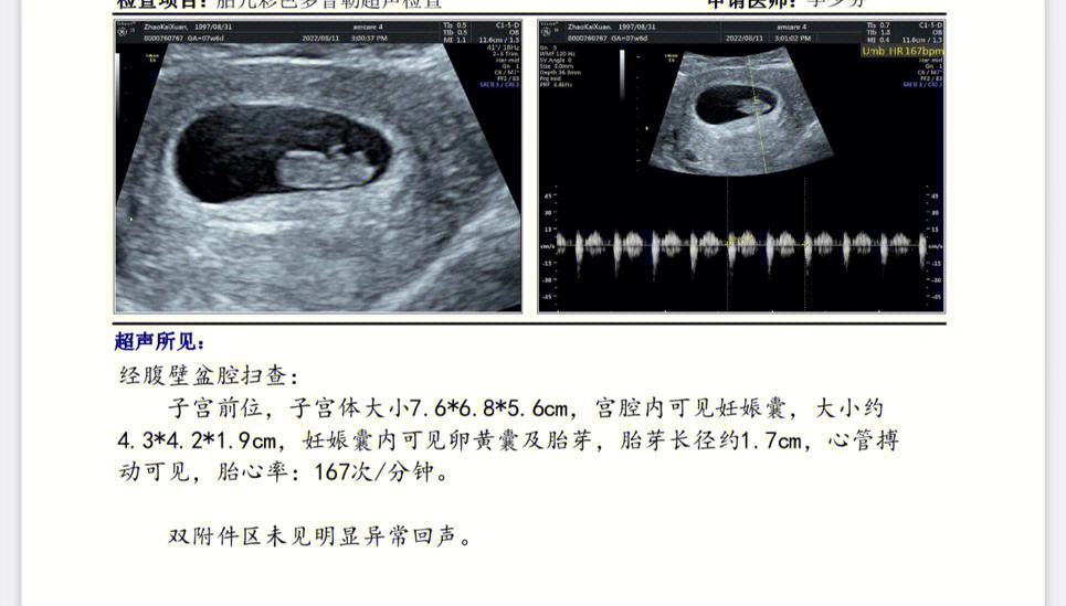 胎儿8周有多大图片图片