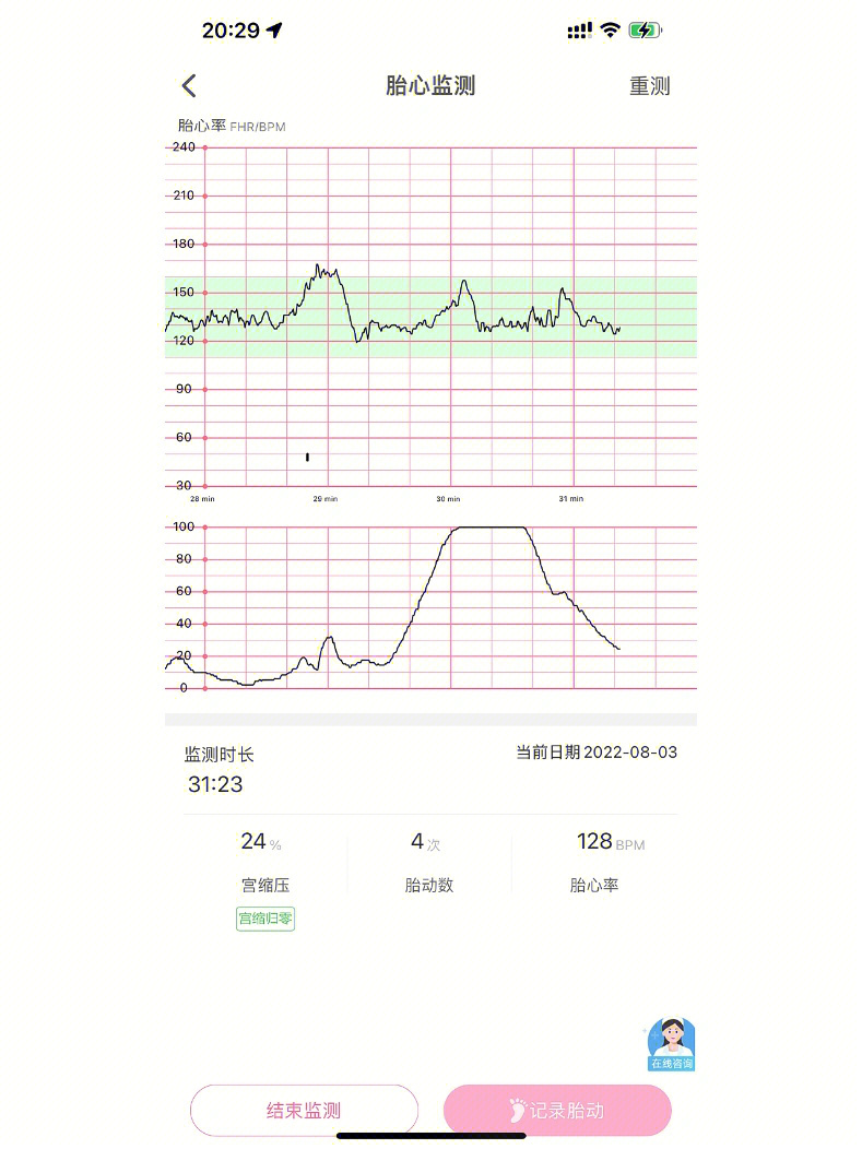 胎监图怎么看胎动次数图片