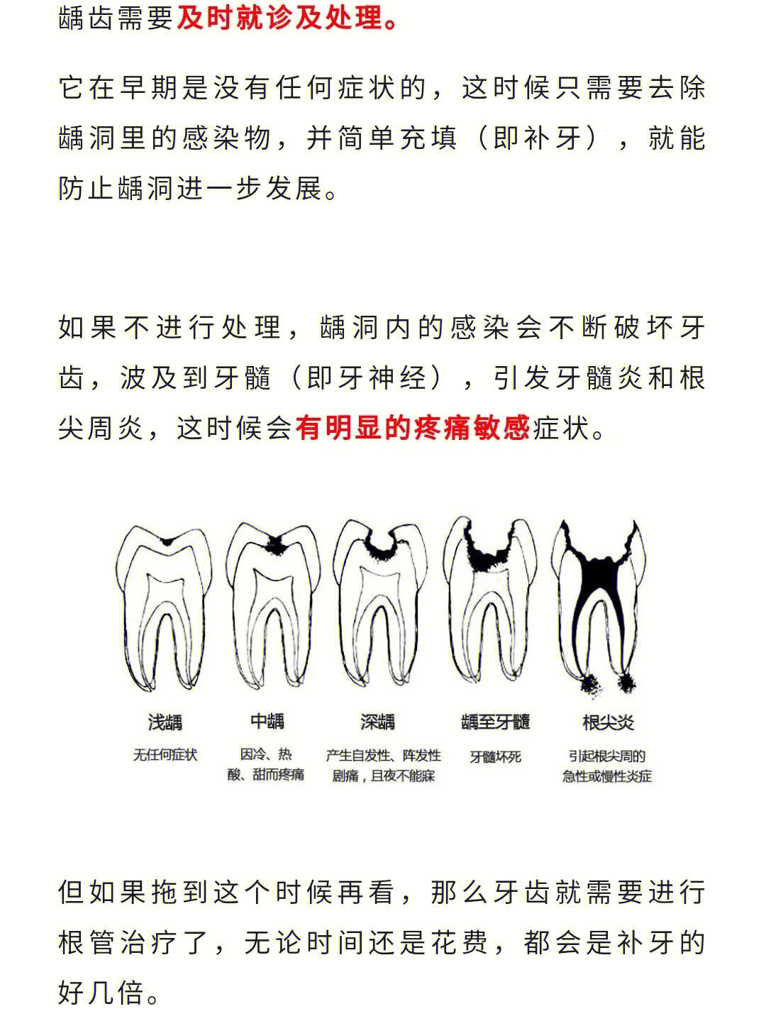 知道自己嘴里有烂牙但不觉得痛要处理吗