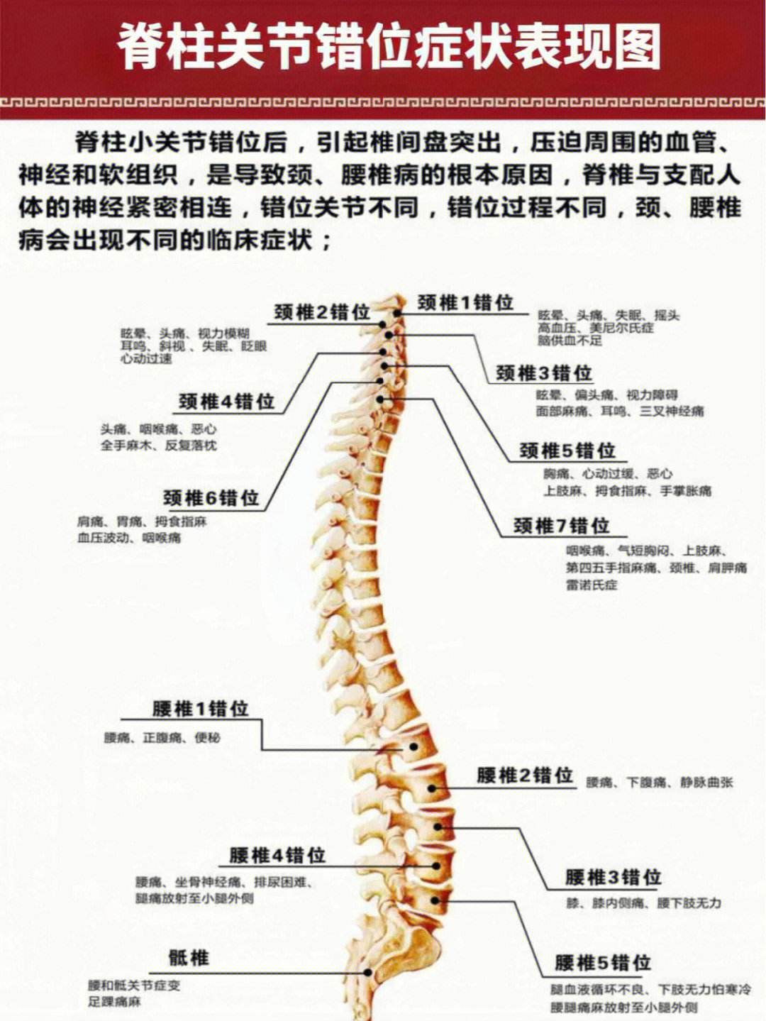 脊椎关节囊图片图片