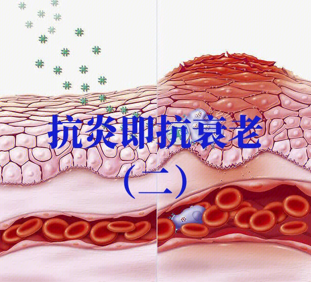 抗炎即抗衰老二