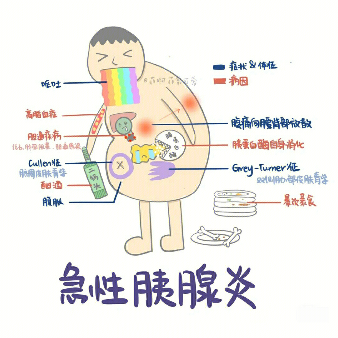 急性胰腺炎 卡通图图片