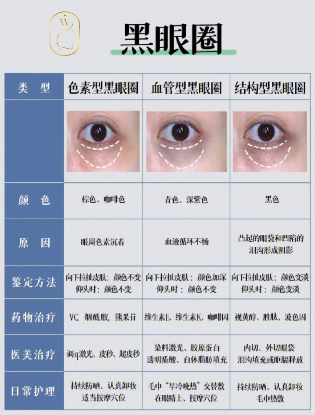 黑眼圈类型对照图图片