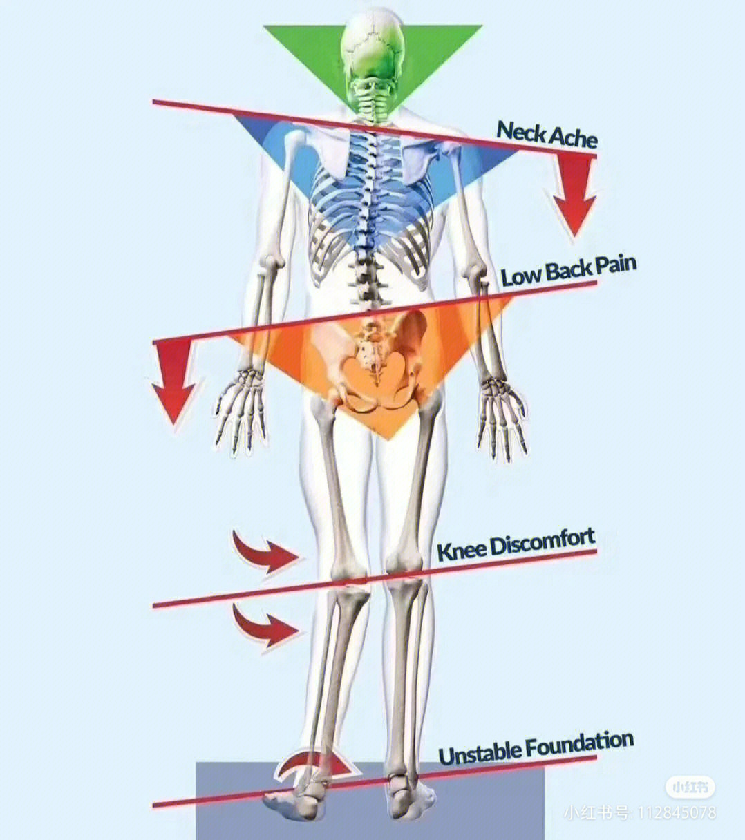 扁平足是如何影响脚踝膝盖骨盆以及肩膀