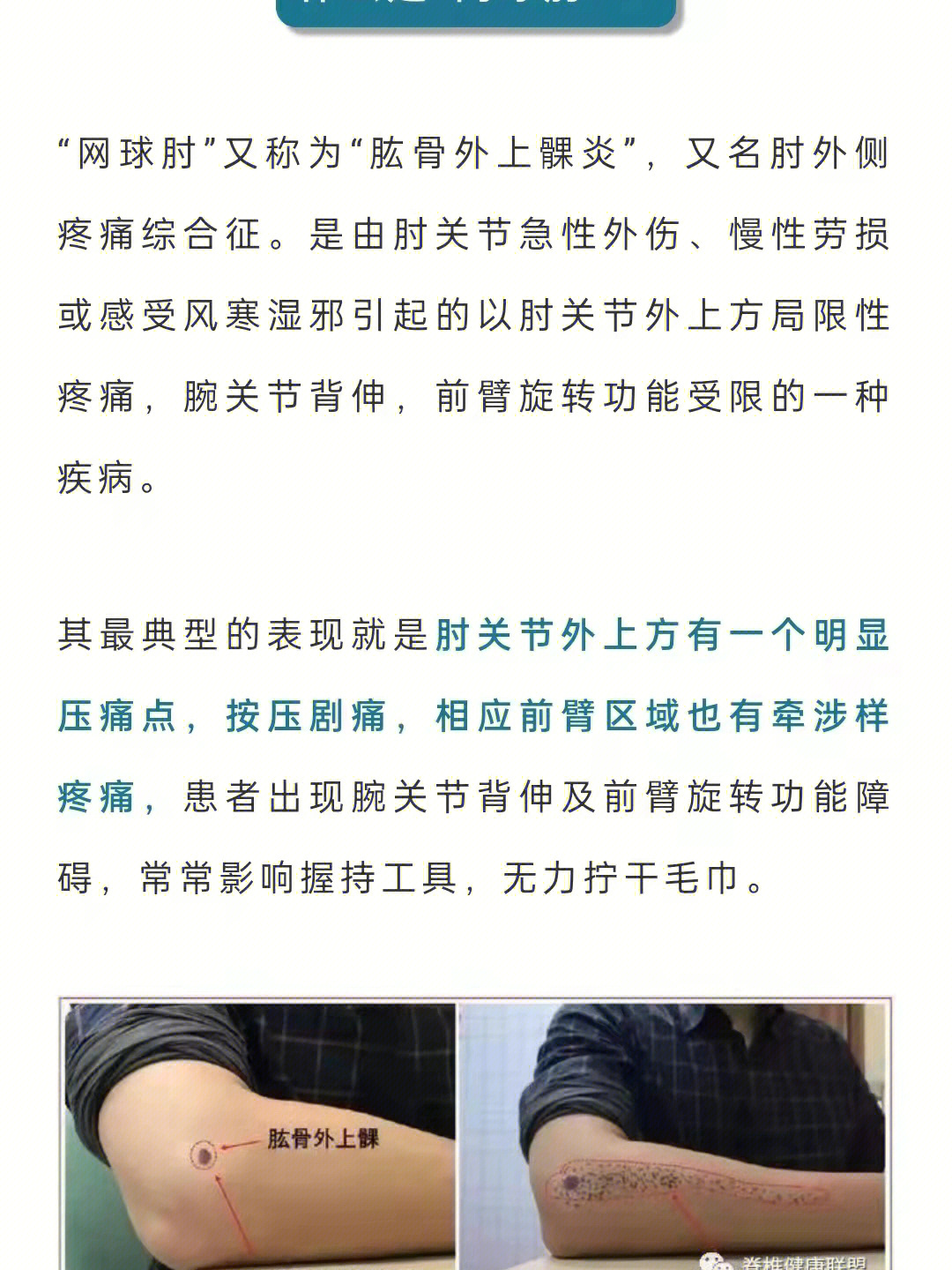 手肘疼痛是怎么回事图片