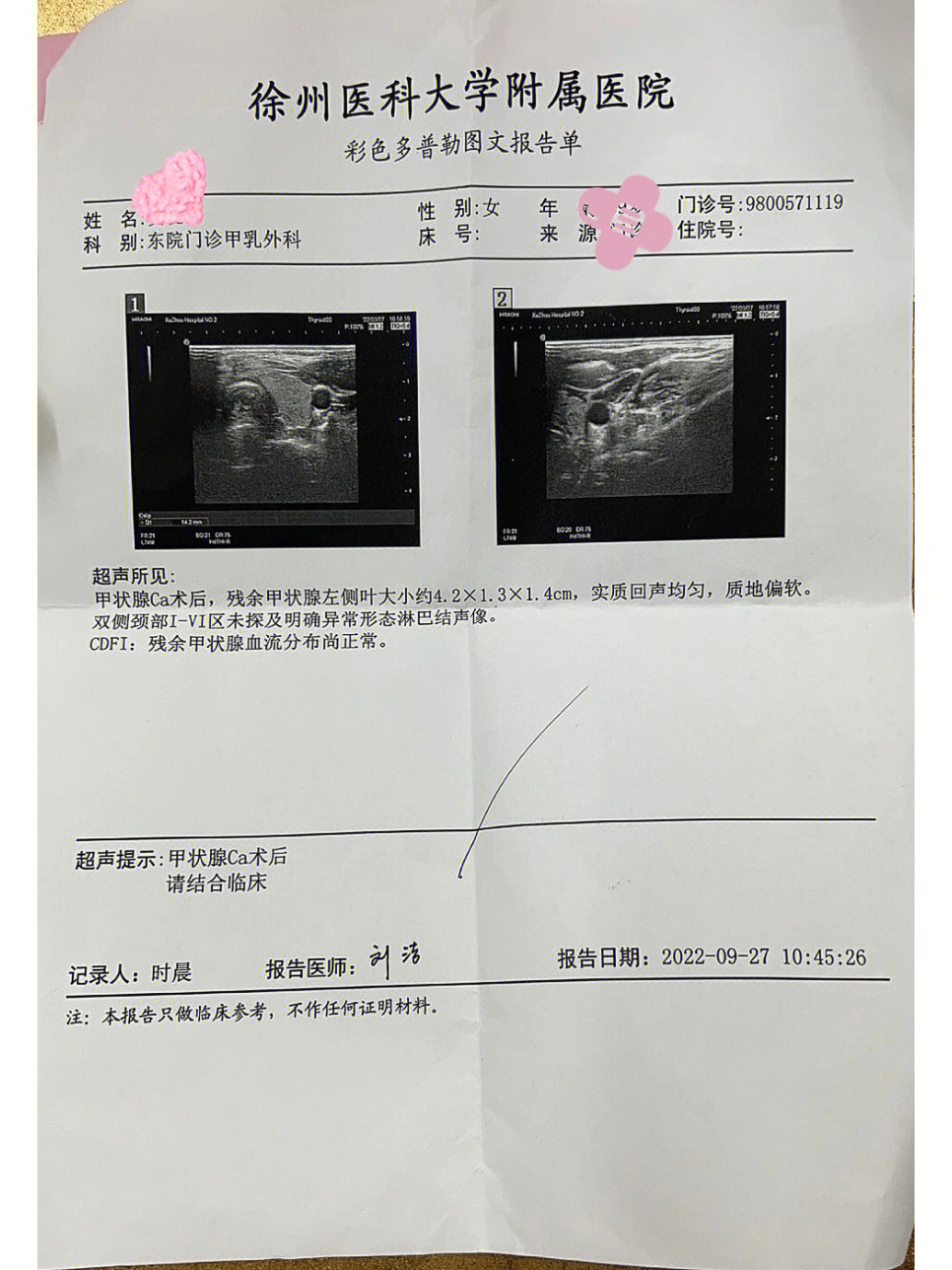 甲状软骨超声图像图片