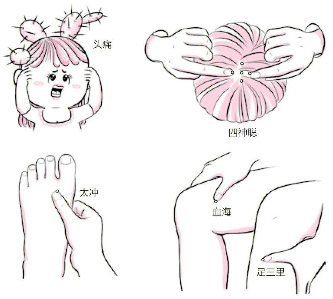 骨髓移植后491天四神聪穴治疗头痛