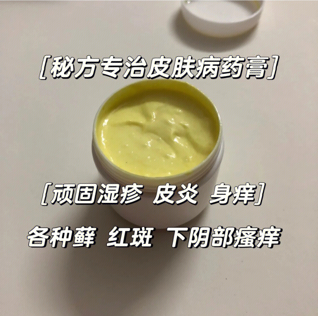 藓类皮肤病怎么治疗图片