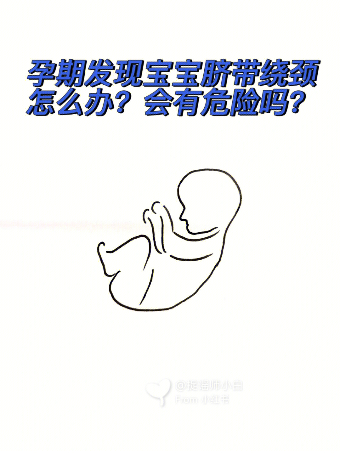 孕期大小宝宝脐带绕颈怎么办有危险吗