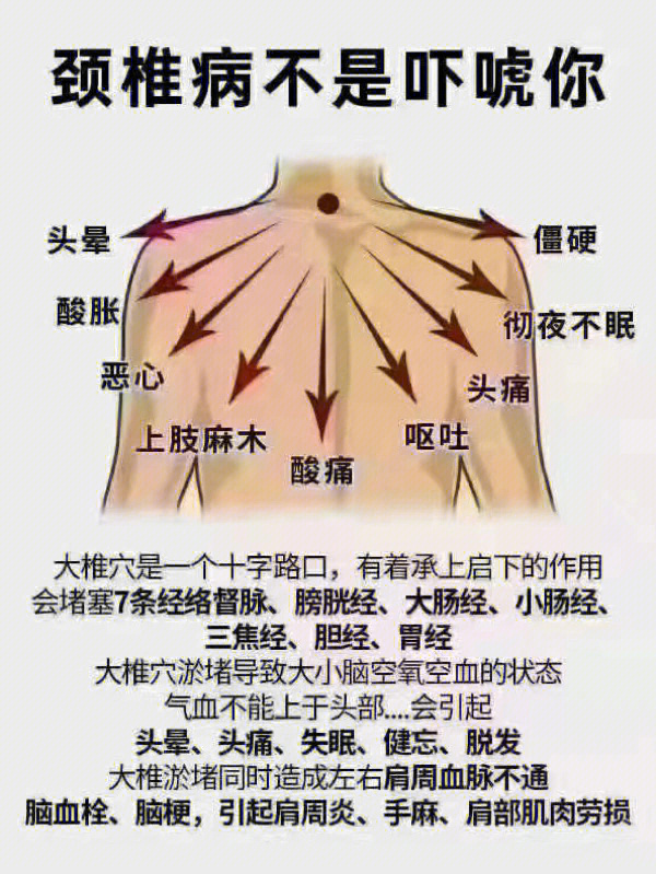 肩颈各个部位疼痛图解图片