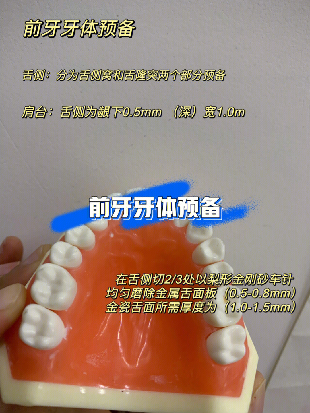 前牙牙体预备