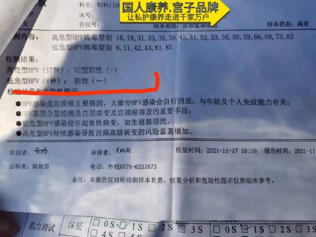 hpv52阳性严重吗图片