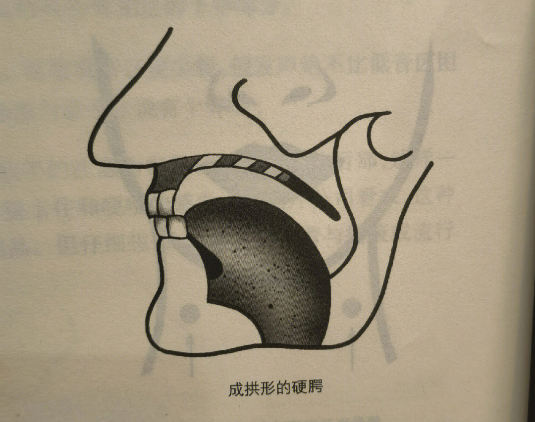 了解自己的硬腭才能解决音色问题