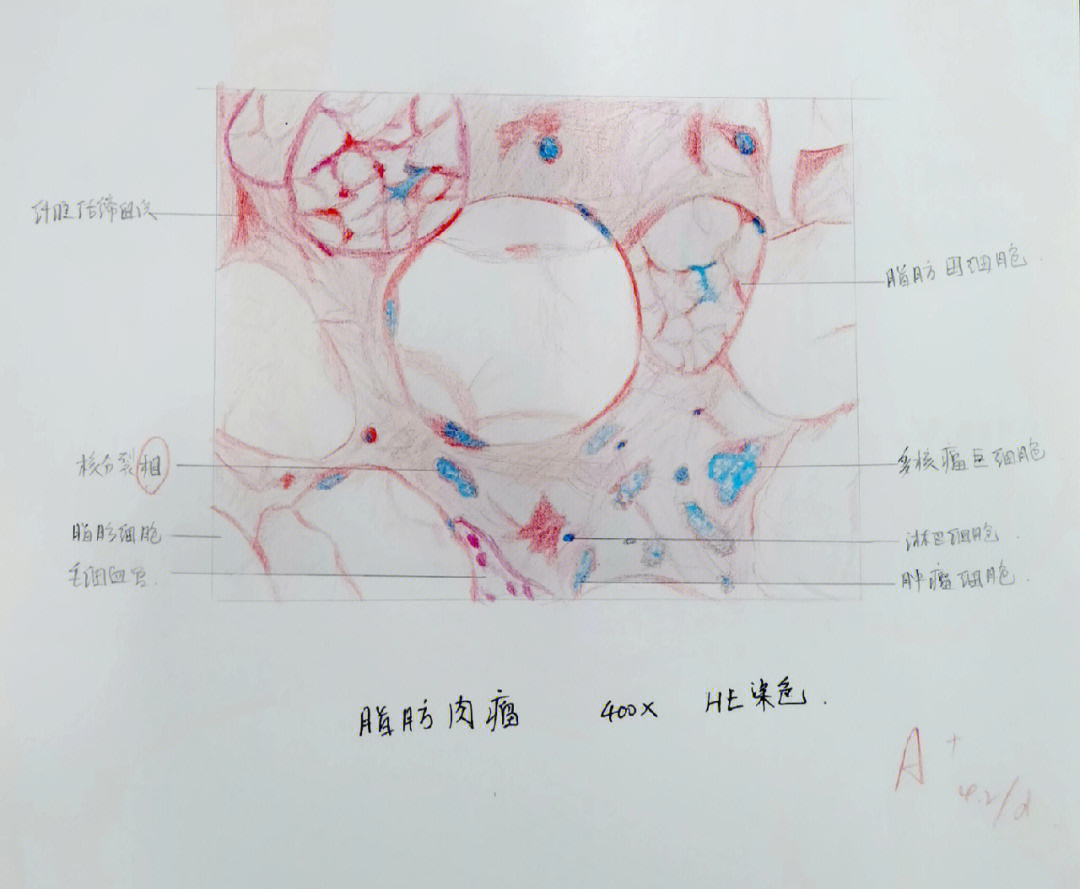 腺体切片手绘红蓝铅笔图片