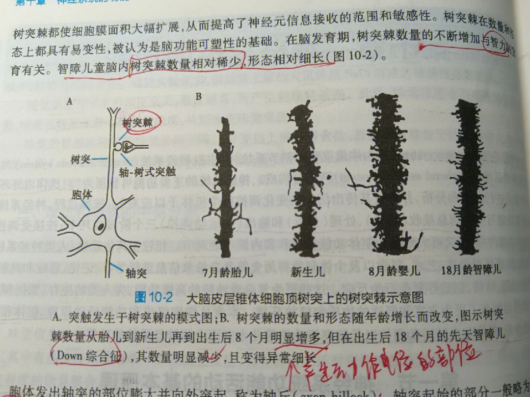 树突示意图图片