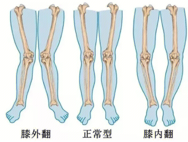 膝超前腿型图图片